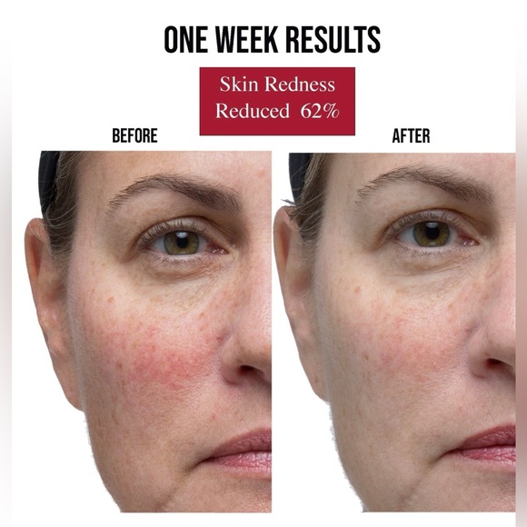 HEYHONEY LUXURY SERUM - Picture 9 of 13